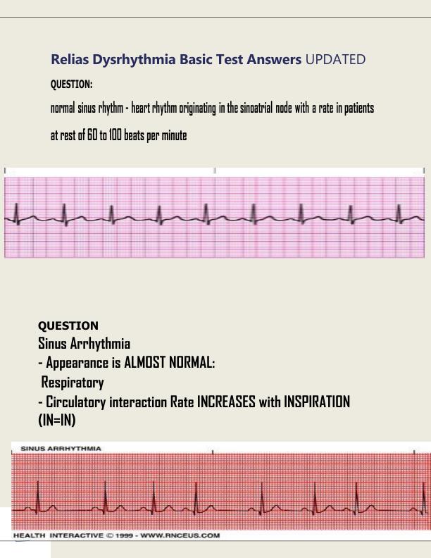 Relias Dysrhythmia Basic Test Answers Solution guide 2023 UPDATED .pdf